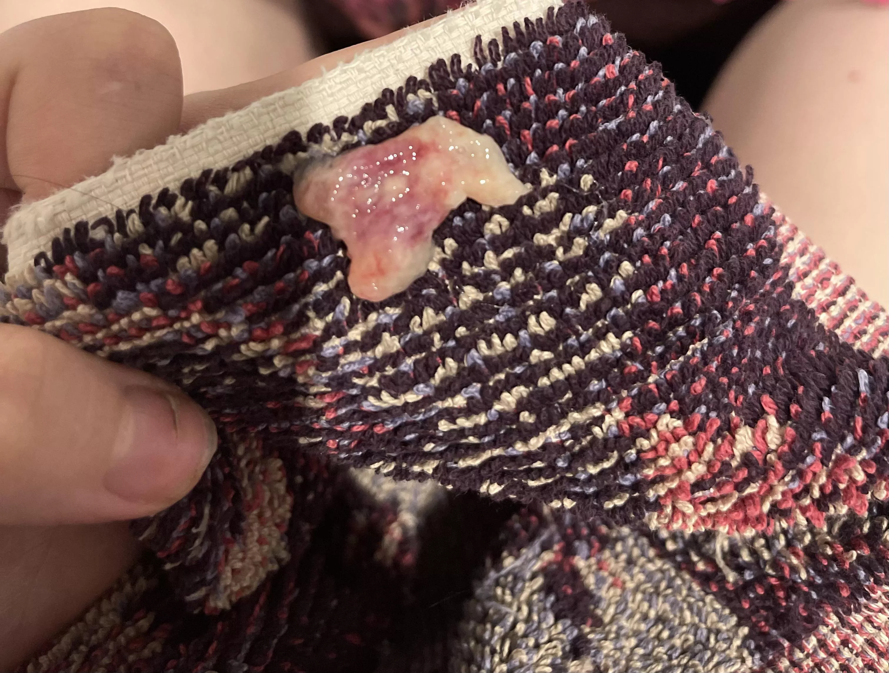 ive been sick for three days and this just came flying out of my nose. I can finally breathe 😭