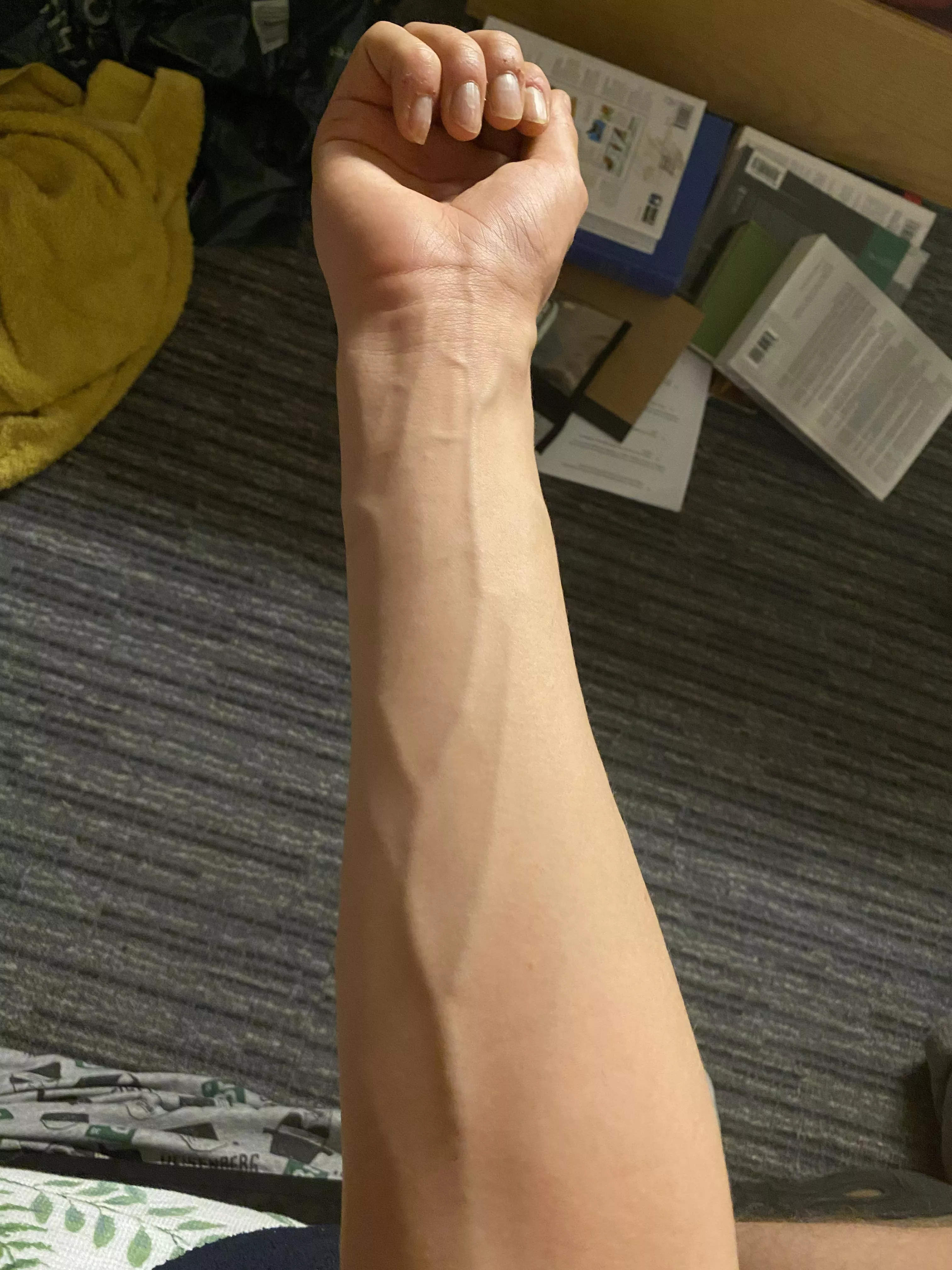 like veins?