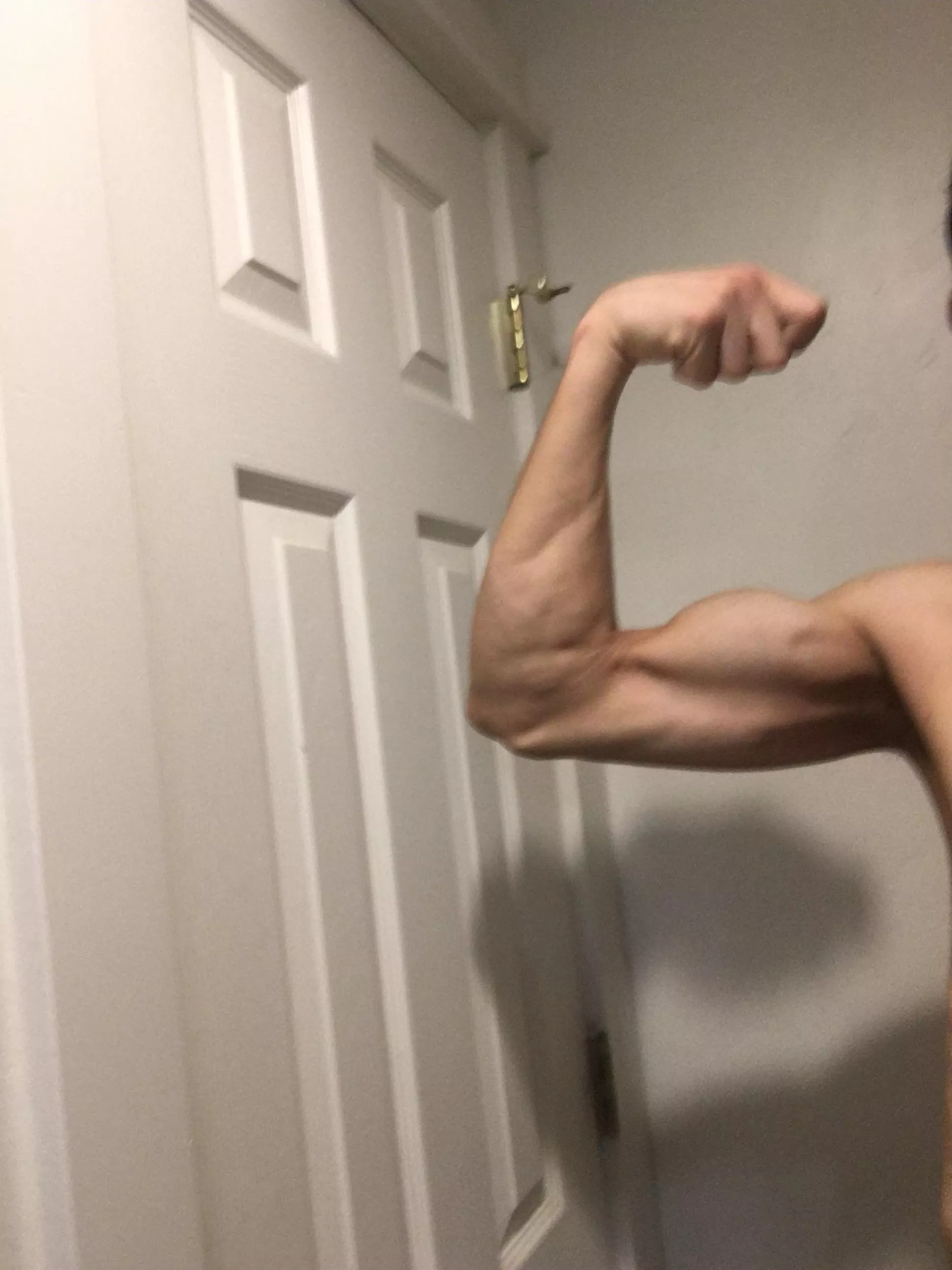 Lol. My shadow looks like a horse hoof