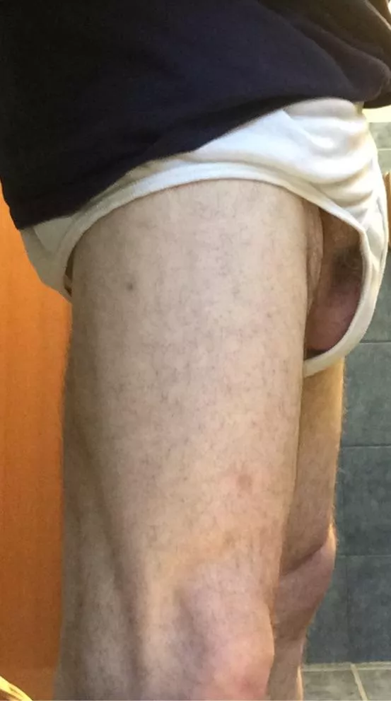 Many people have mentioned that my briefs look loose. They are. I worked hard to lose a lot of weight and so now they are Bacci. Here is a close-up so you can see just how baggy.