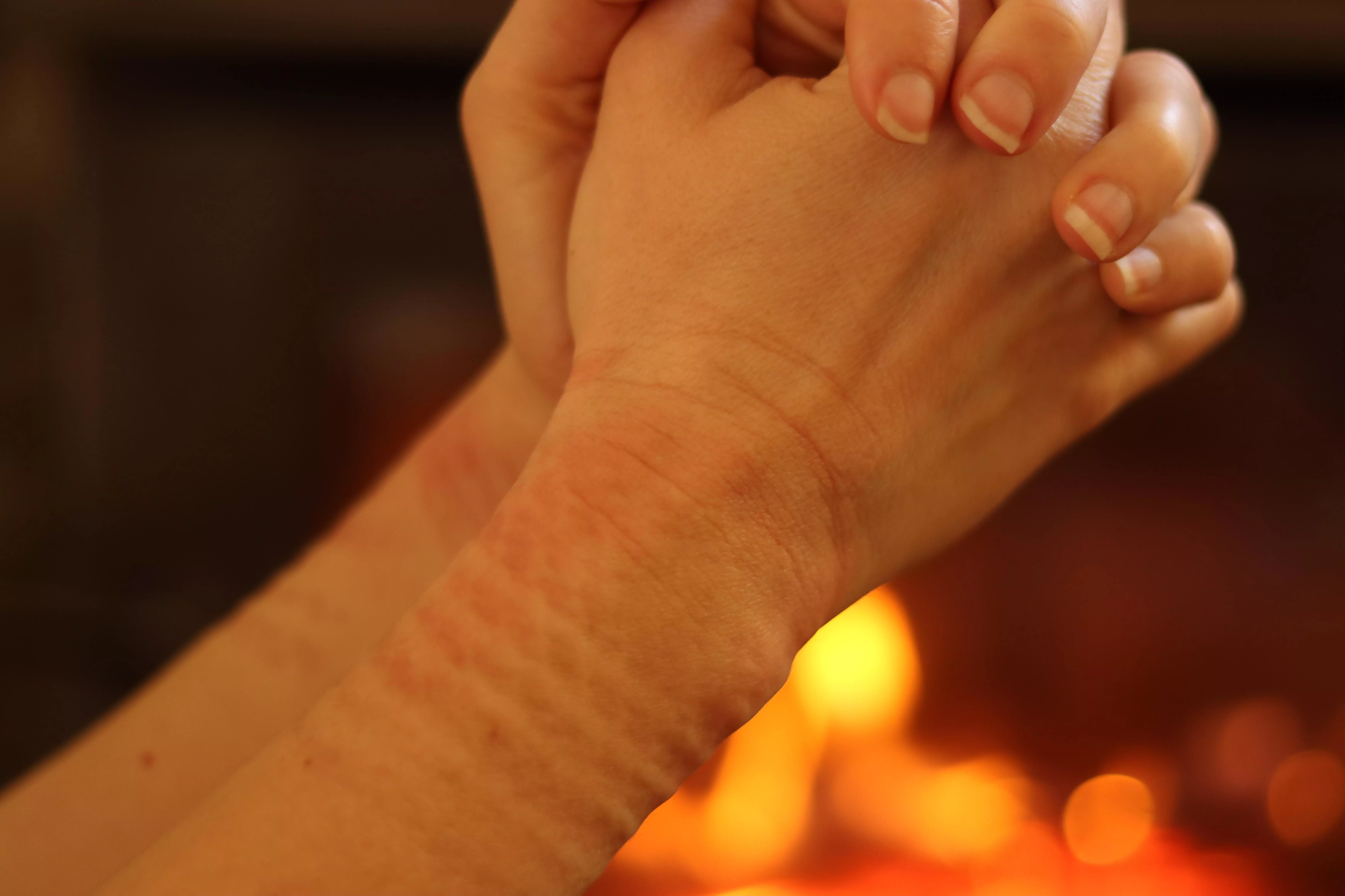 marks from being tied ✨️😌