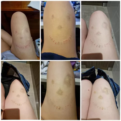 Medical play marks progression