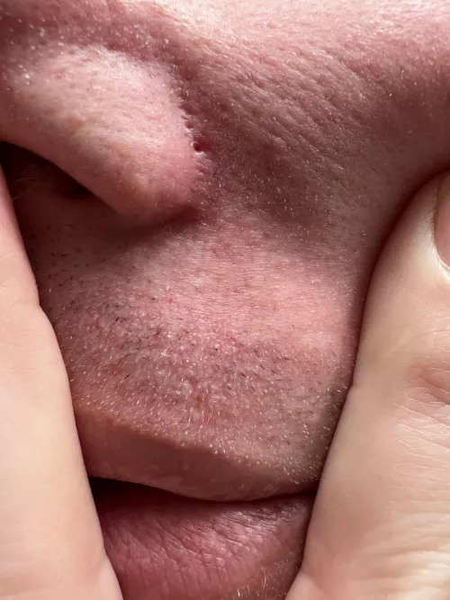 Missed the pop but here’s the hole it left.