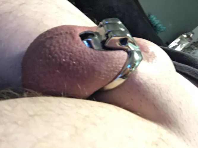 My balls are now 2-3 times the size of my caged penis. I wish I could be let out.