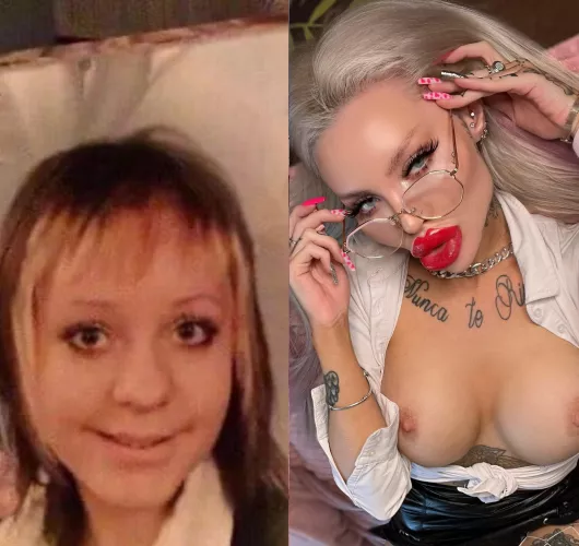 Natural me vs fake (and happy) me ⨠I got fresh lip fillers btw, 18cc now and will get more cc soon. Also 1200cc boobs is waiting āØšš¼