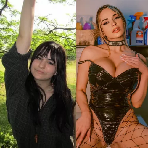 On my way to look like a blow up doll! I’m so proud of my journey so far though ☺️