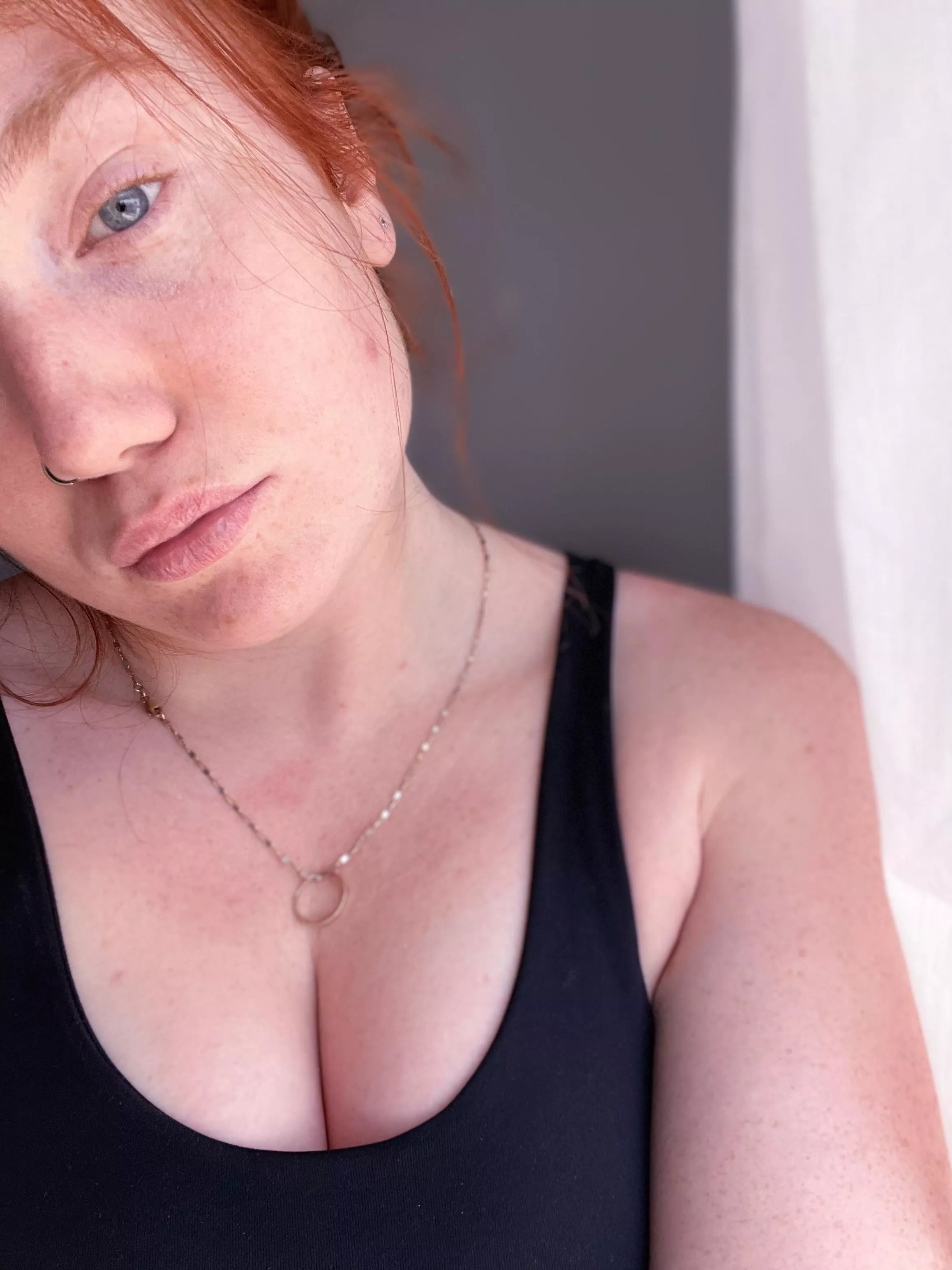 One big freckle.