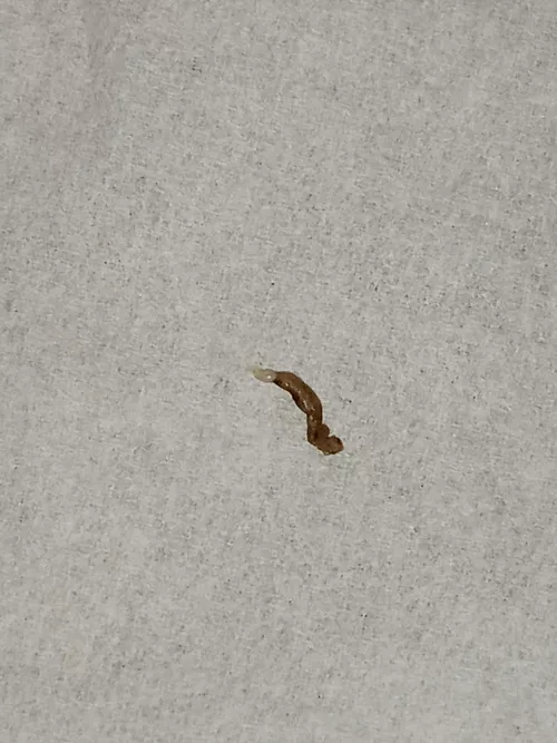 Pulled for Bikini line can't tell if big black head or little dpow; left a little hole behind