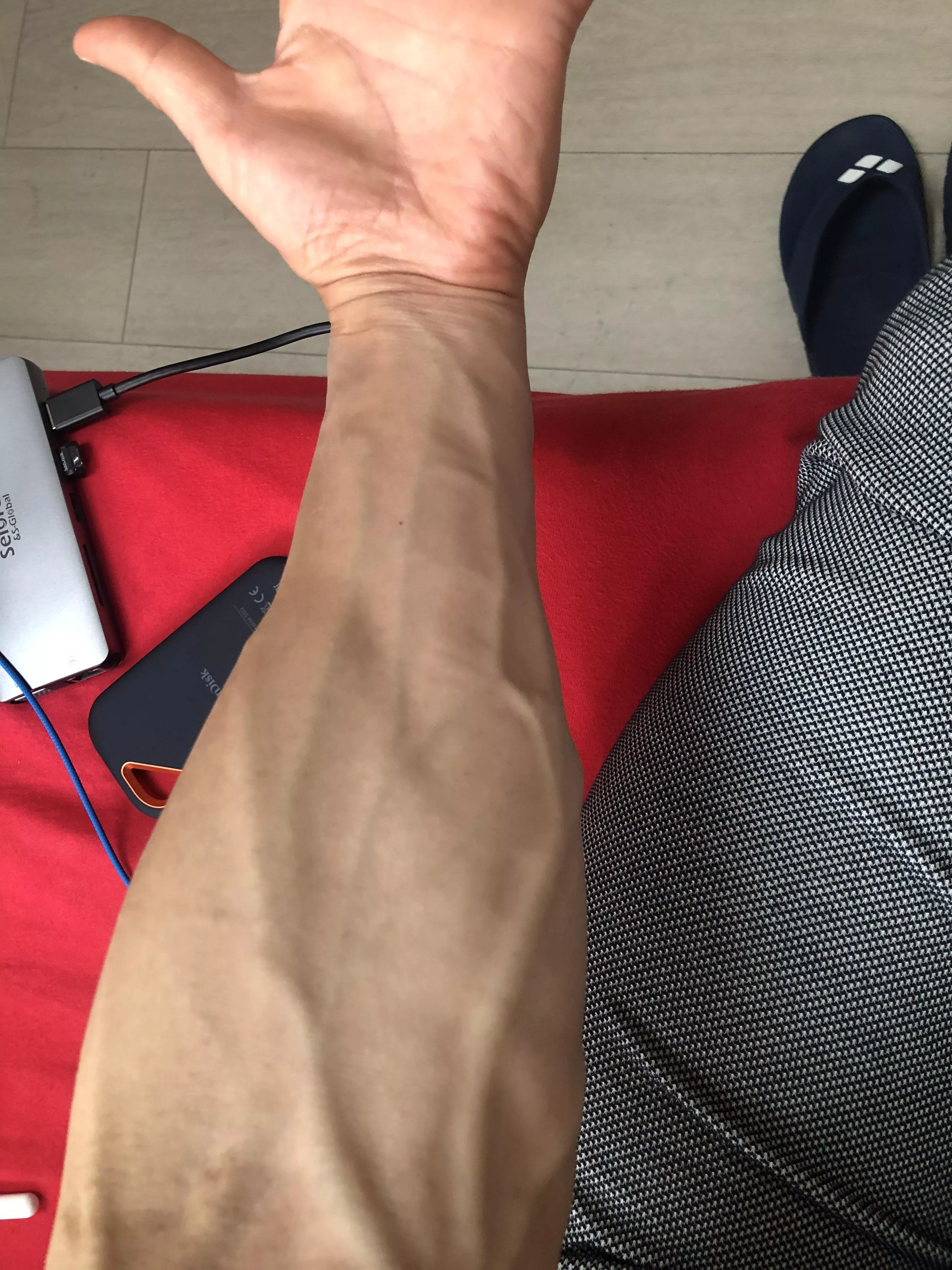 Saturday‘s forearm