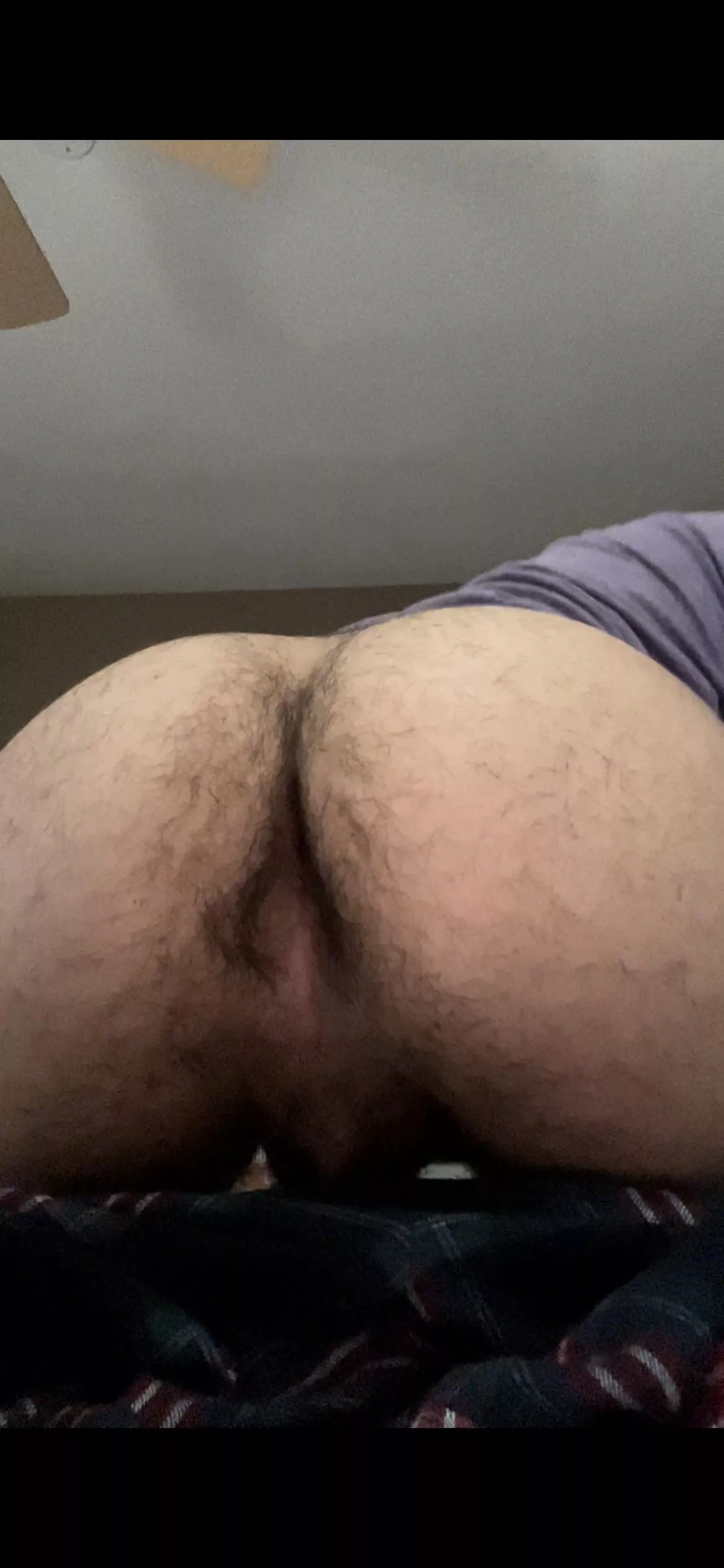 So hairy [19]