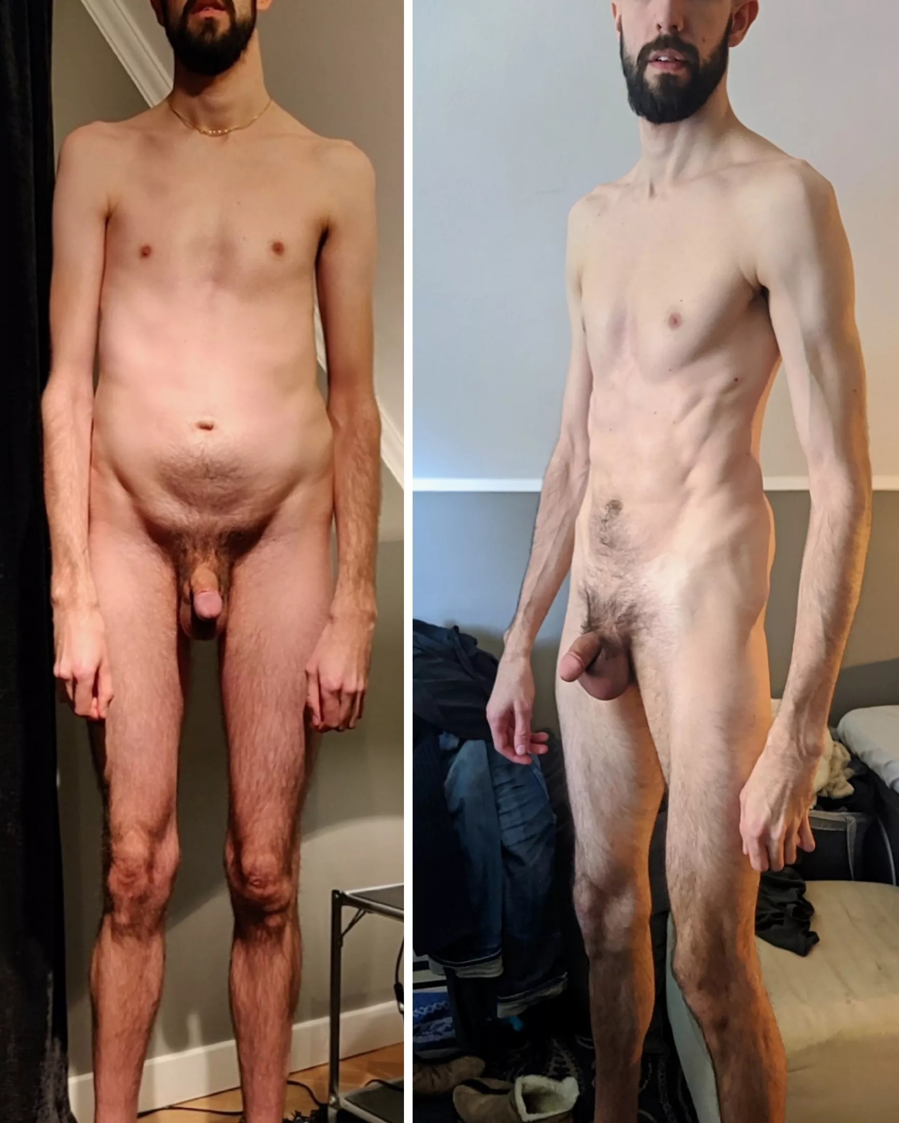 Started making changes at 27, now I'm 30 and I always need to look back to remember where I started to not lose hope. Weight is about the same in both pictures. Oh and I have Marfan's Syndrome in case you were wondering Started making changes at 27, now I'm 30 and I always need to look back to remember where I started to not lose hope. Weight is about the same in both pictures. Oh and I have Marfan's Syndrome in case you were wondering