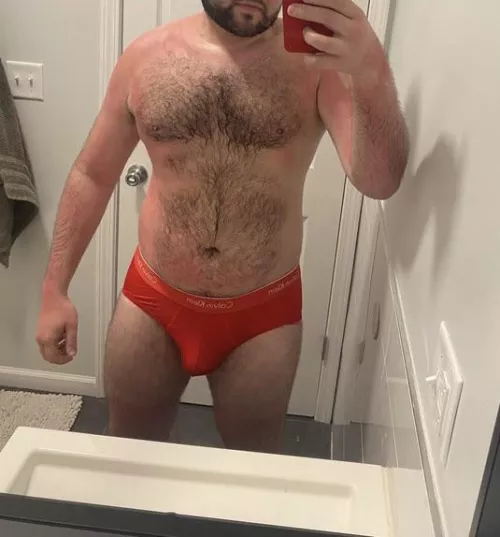 Sunburnt bear cub. Help me with the aloe?