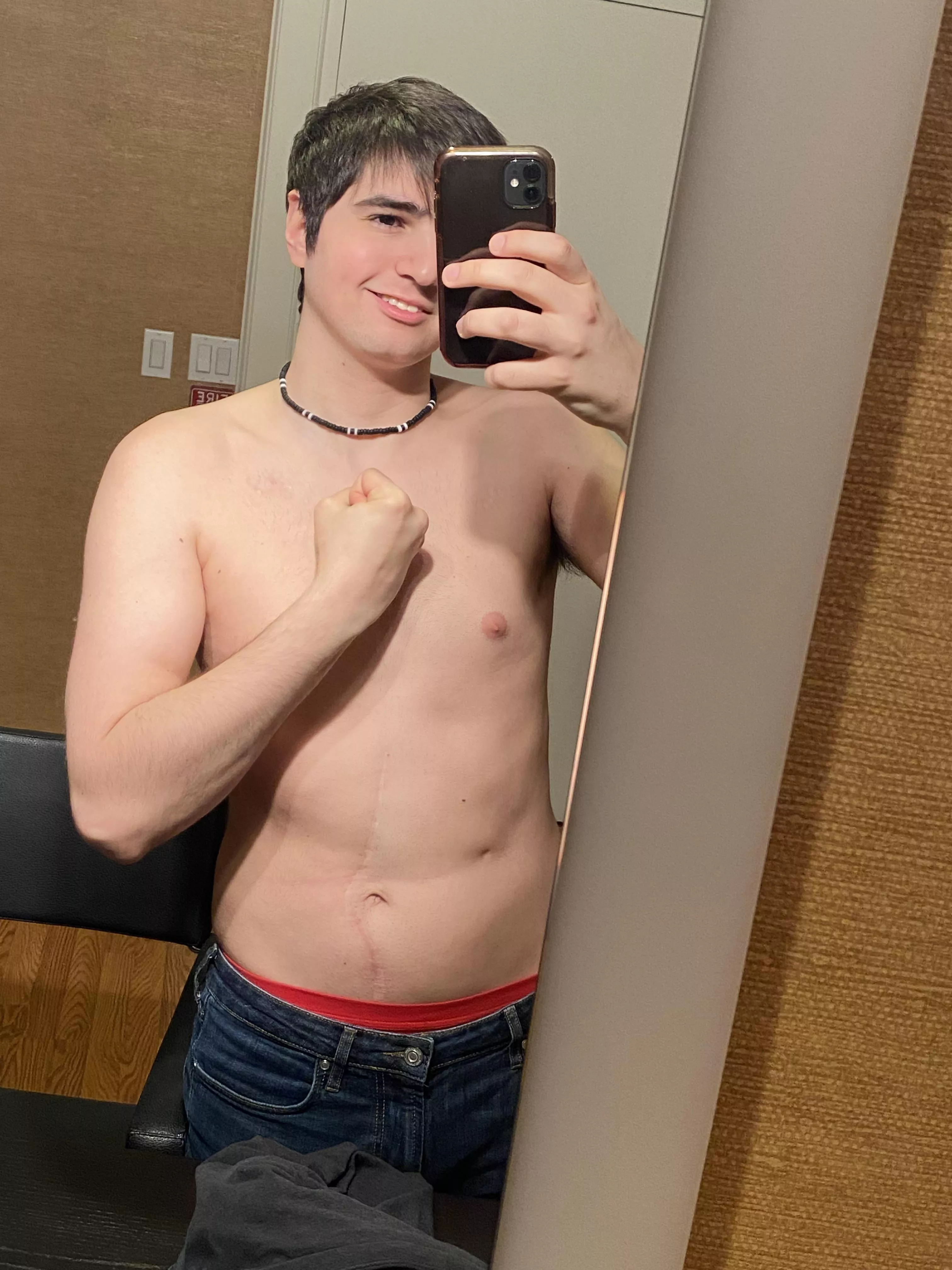 Thank you to all the people who commented on my post yesterday about my missing eye. It really meant a lot. I’m glad this community is so loving. Kind of the opposite you expect from Reddit sometimes.