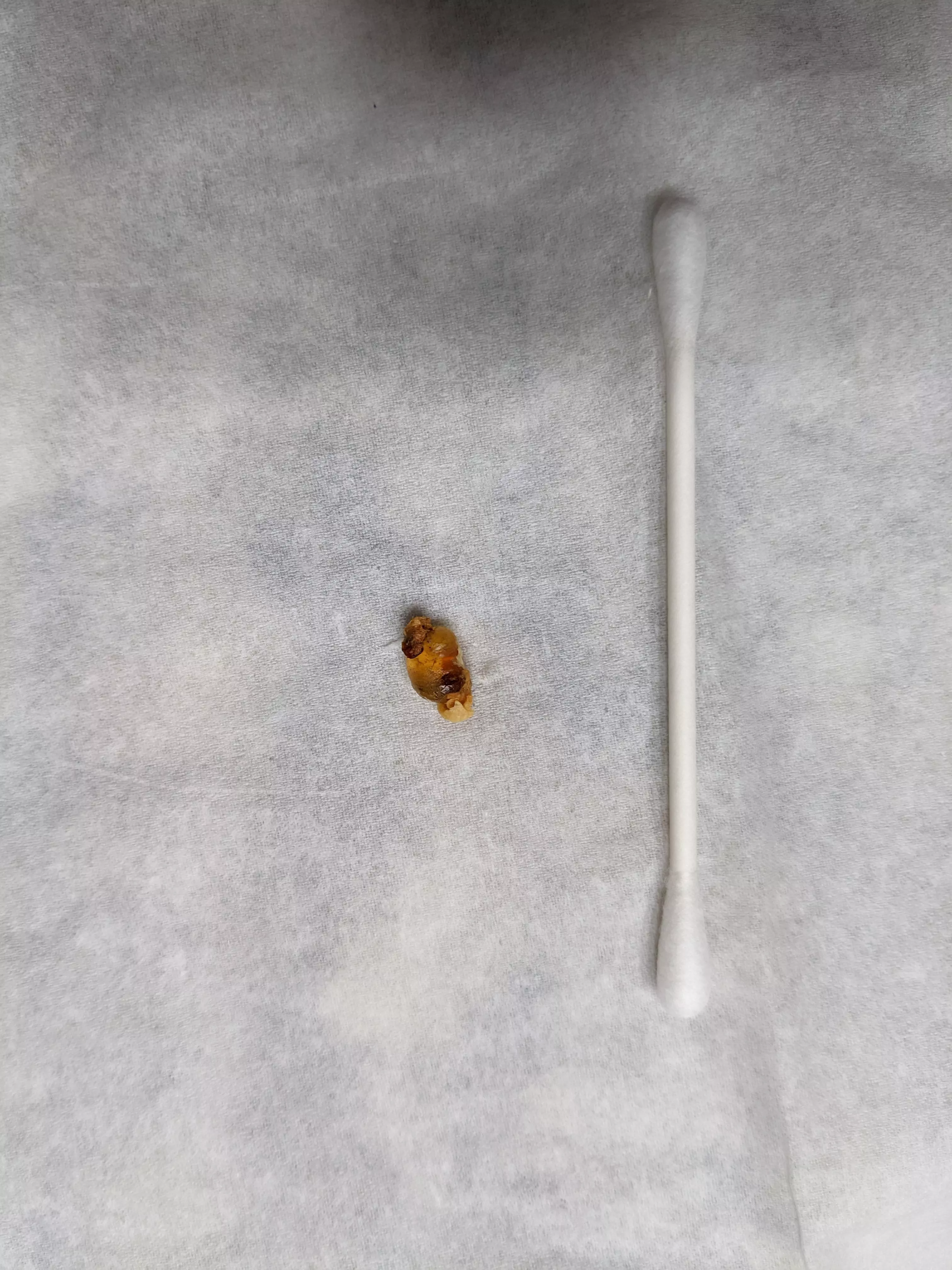 This wax-crusted chunk of what felt like silicone gel we pulled out of my 6YO's ear.
