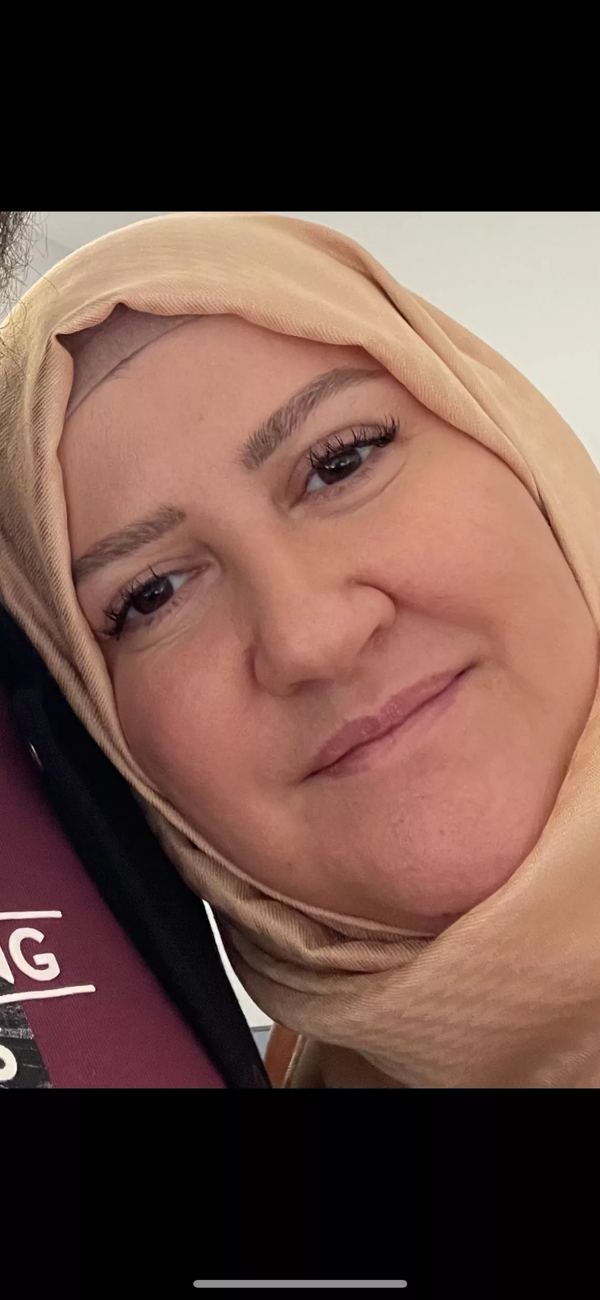 Those who want to tribute to my mother's face, send a message, kik moonsubbb