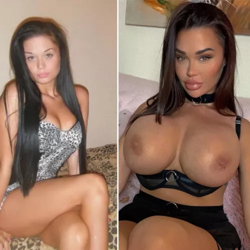 Tiny to an okay size (900cc). BUT surgeon just gave the go ahead for 1500cc’s next month!!