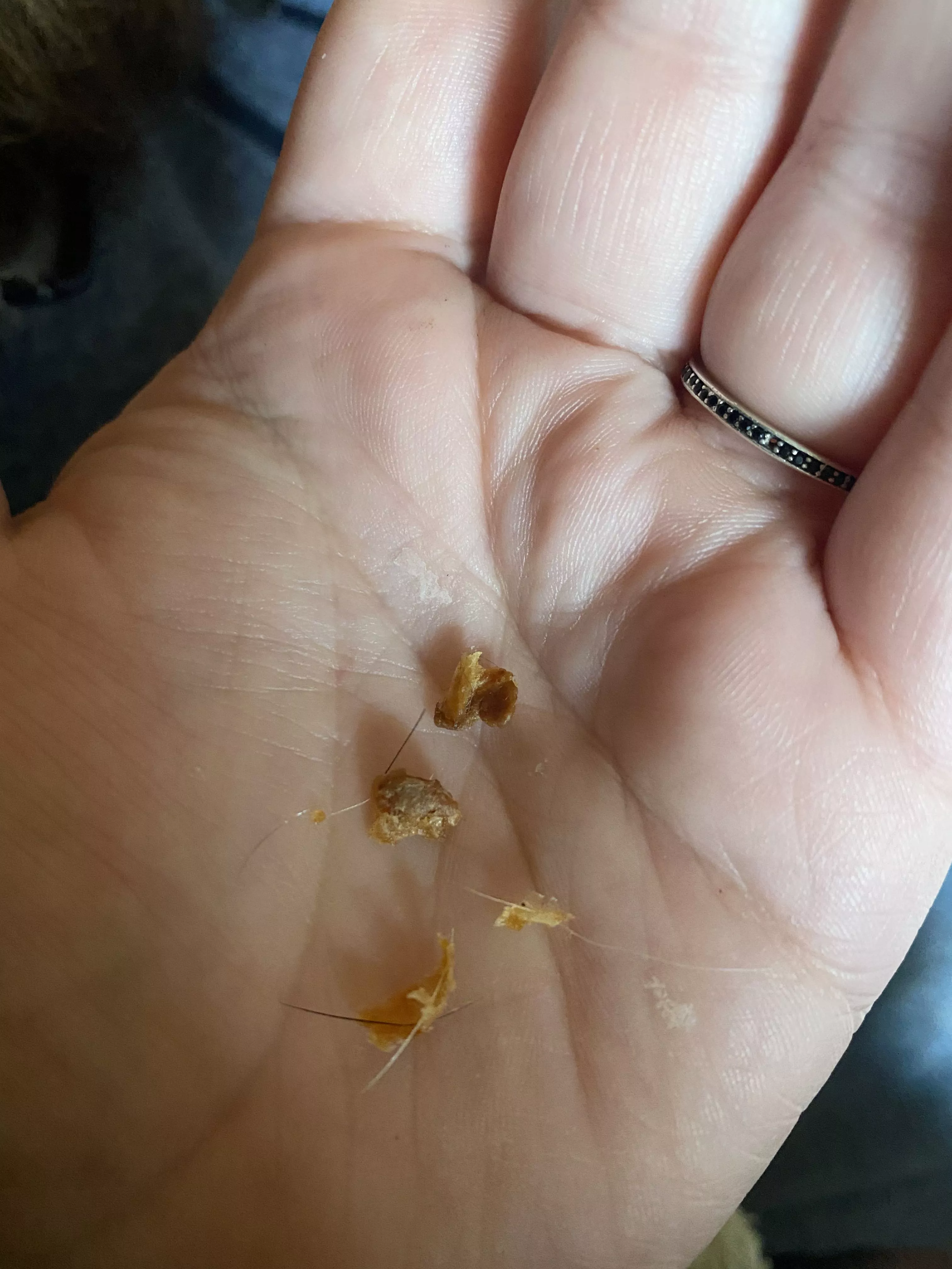 Treasure mine I pulled from my husband’s ear