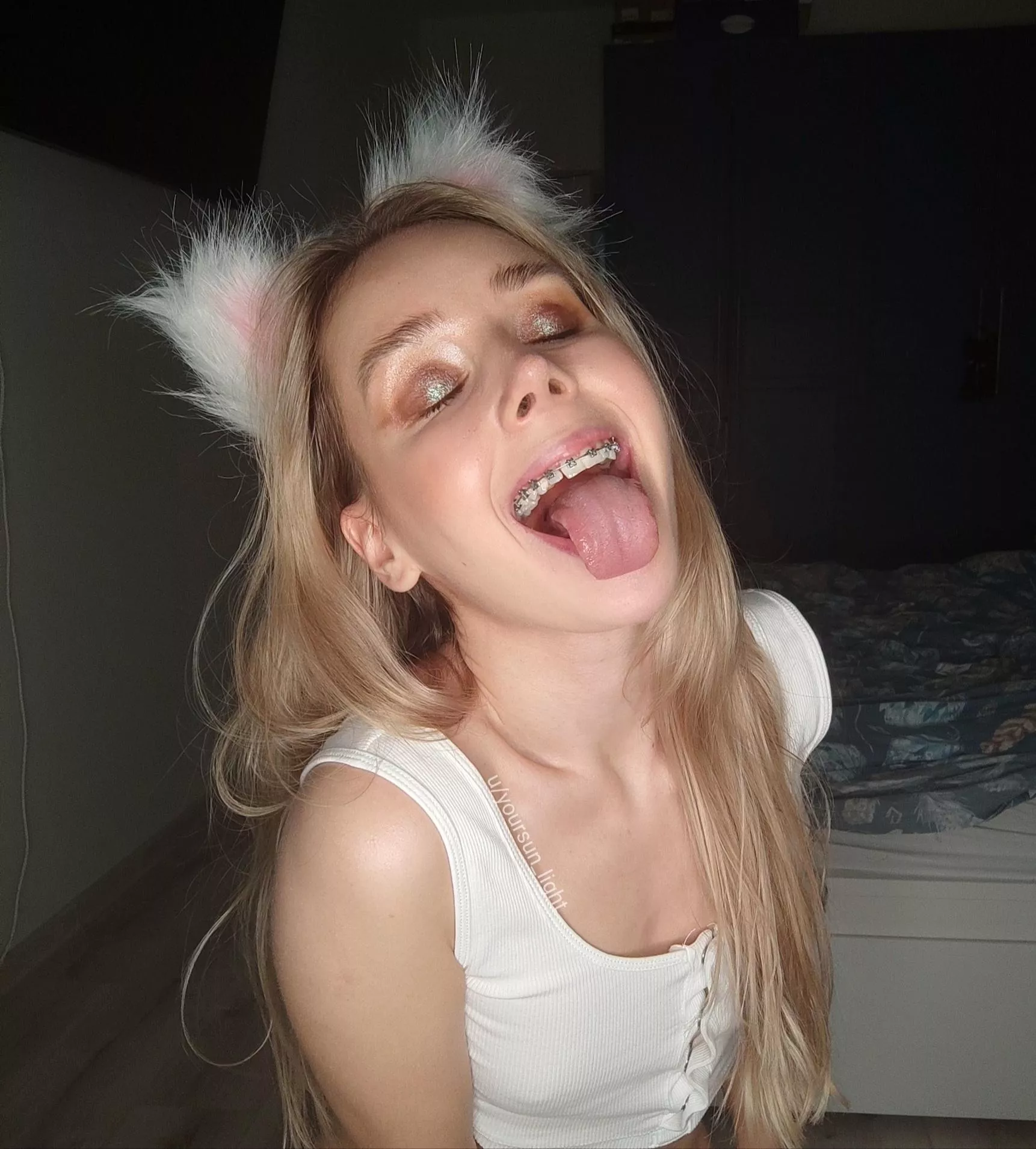 Wanna cum on my braces?