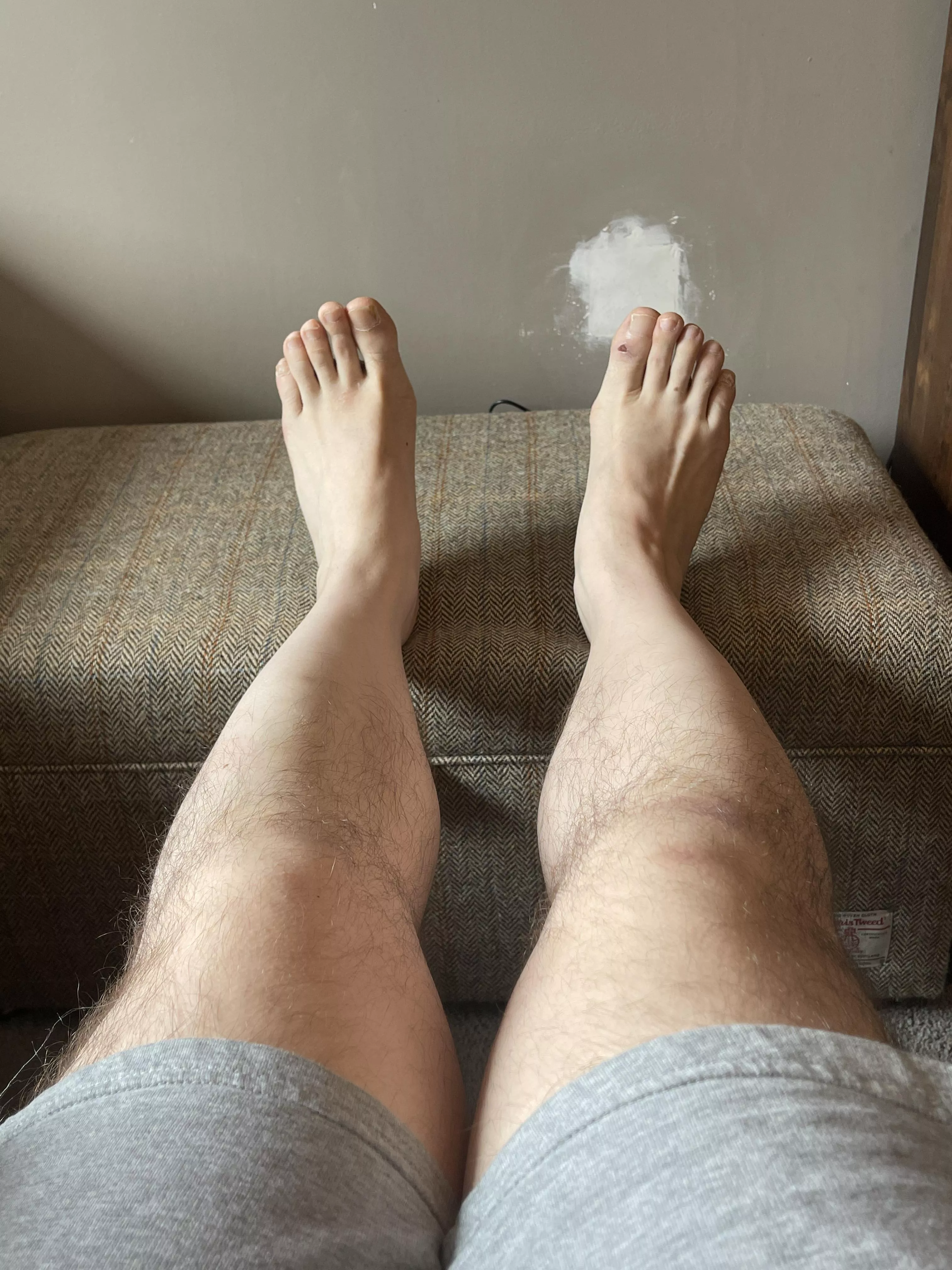 What is the consensus on my feet?