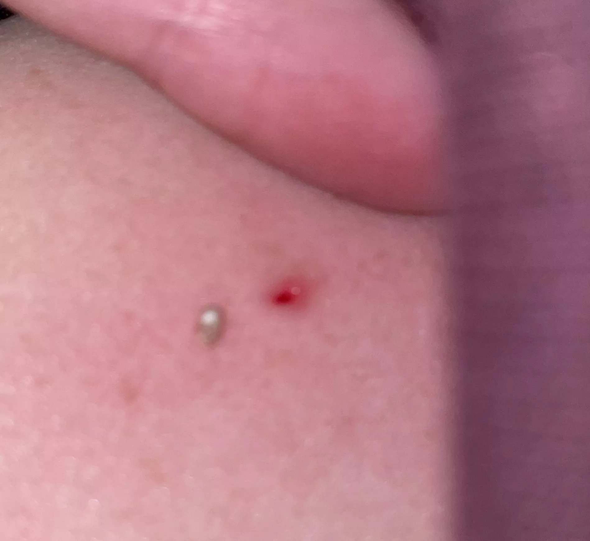 What’s this thing? It’s very hard, looks like a small stone.