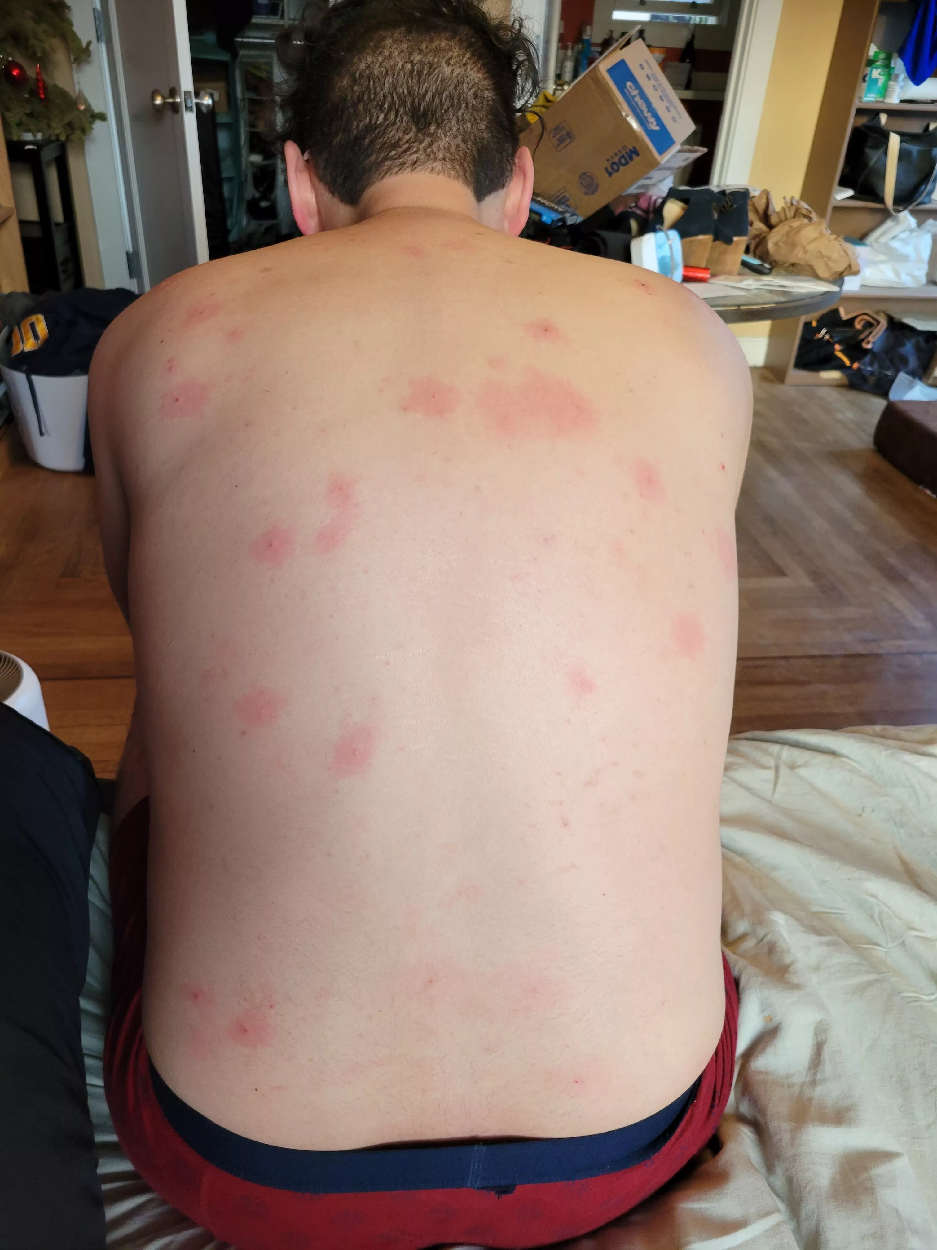 When you let your girlfriend go to town on your back