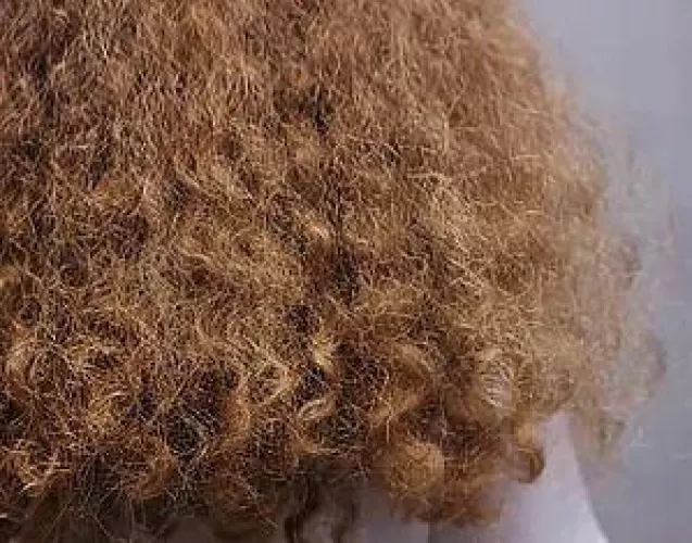With limited products and being unable due to parents now allowing because not supporting my hair till I’m 18, I’m 16 now, how can I make this more beautiful? I want to embrace it. Is it excessively thick? Please DM if you’re comfortable too becaus