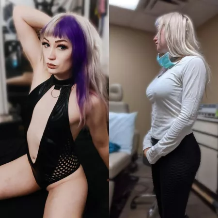 Getting my first surgery tomorrow! Left is before and right is the try on. Getting my first surgery tomorrow! Left is before and right is the try on.