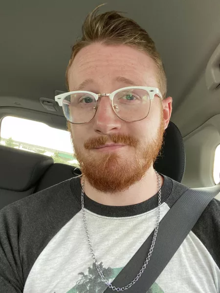 Got a tiny burn while in Florida Got a tiny burn while in Florida