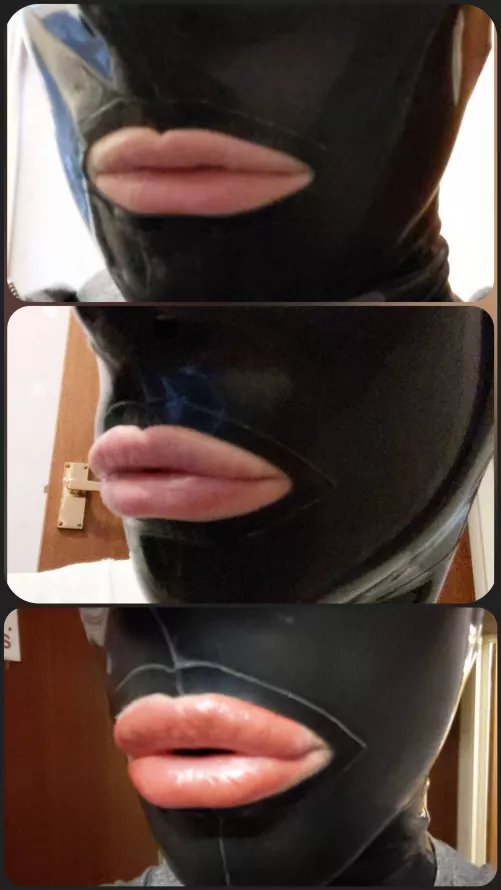 Lip filler progression. Must. Go. Bigger Lip filler progression. Must. Go. Bigger