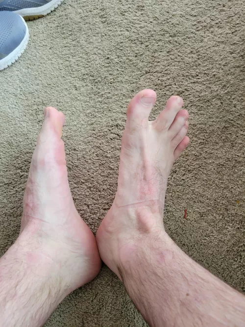 Post work out feet Post work out feet