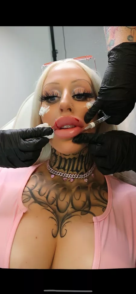 Thinking about dick as I’m getting injected w more plastic 💉 I love being a bimbo fuck doll 💘 Thinking about dick as I’m getting injected w more plastic 💉 I love being a bimbo fuck doll 💘
