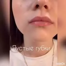 Does anyone have either of the two gifs of her, looks like they got removed off redgifs