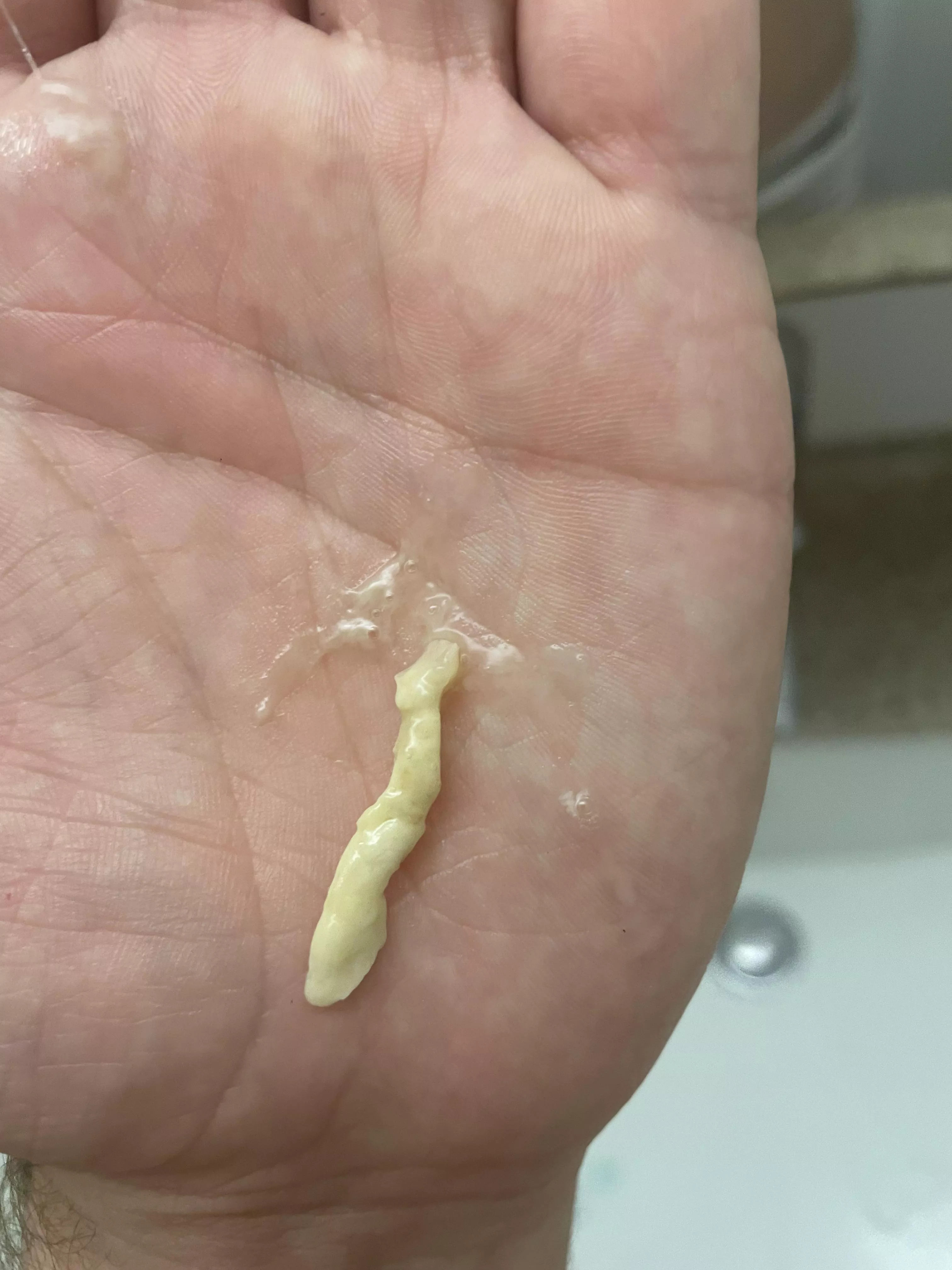 I had a painful blockage in my tear duct, and this came out (Dacryolith)
