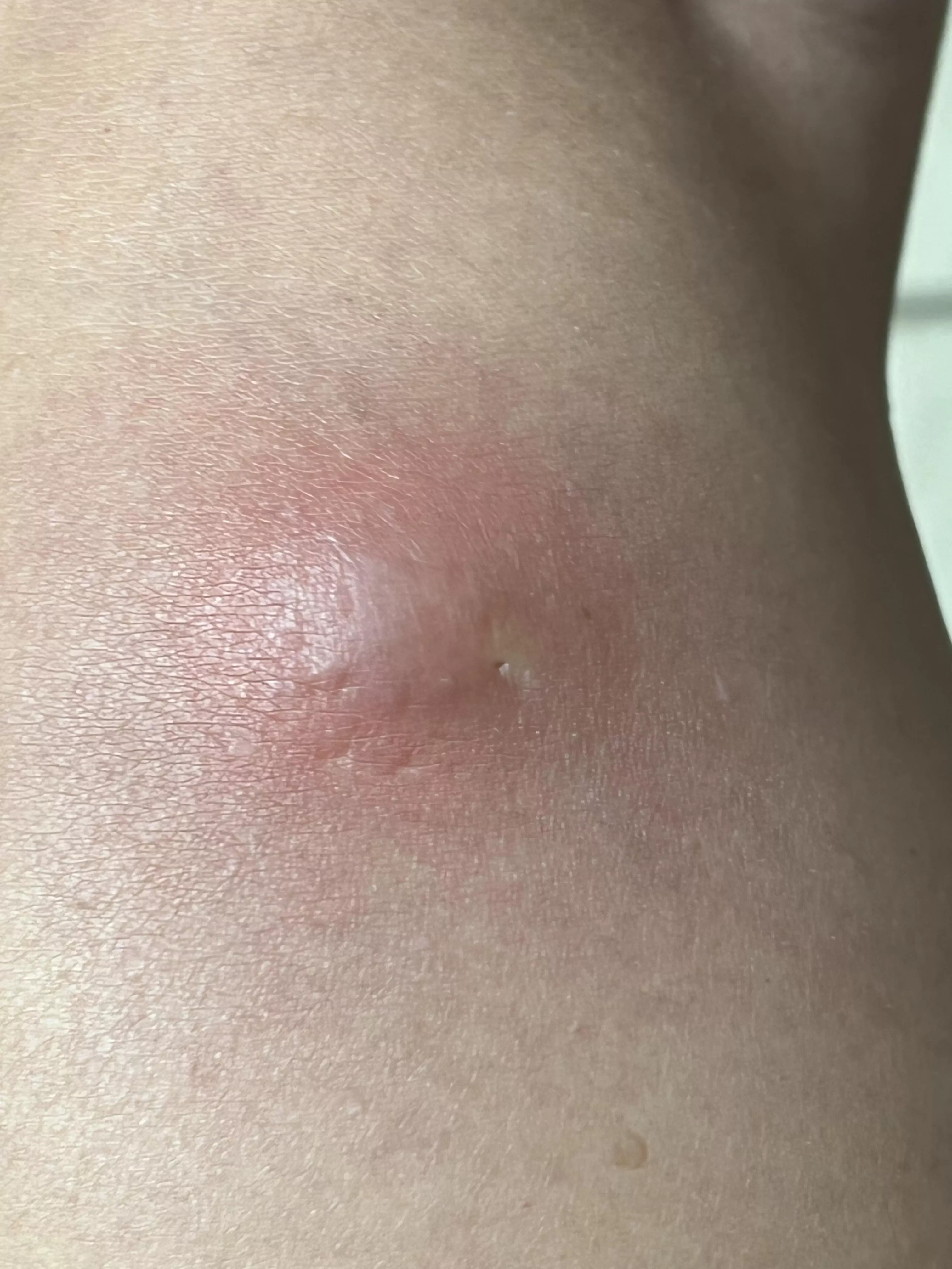 She won’t let me pop it