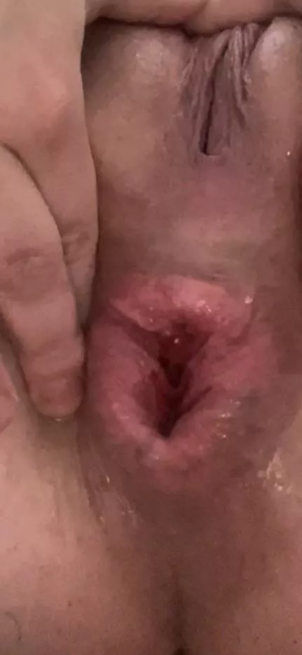 Would you ever believe I’m 20 because of the appearance of my asshole?