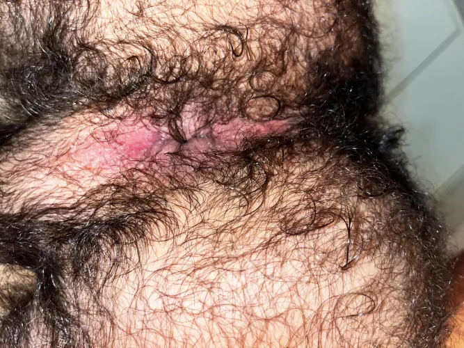 just in case some of you wanted to see more