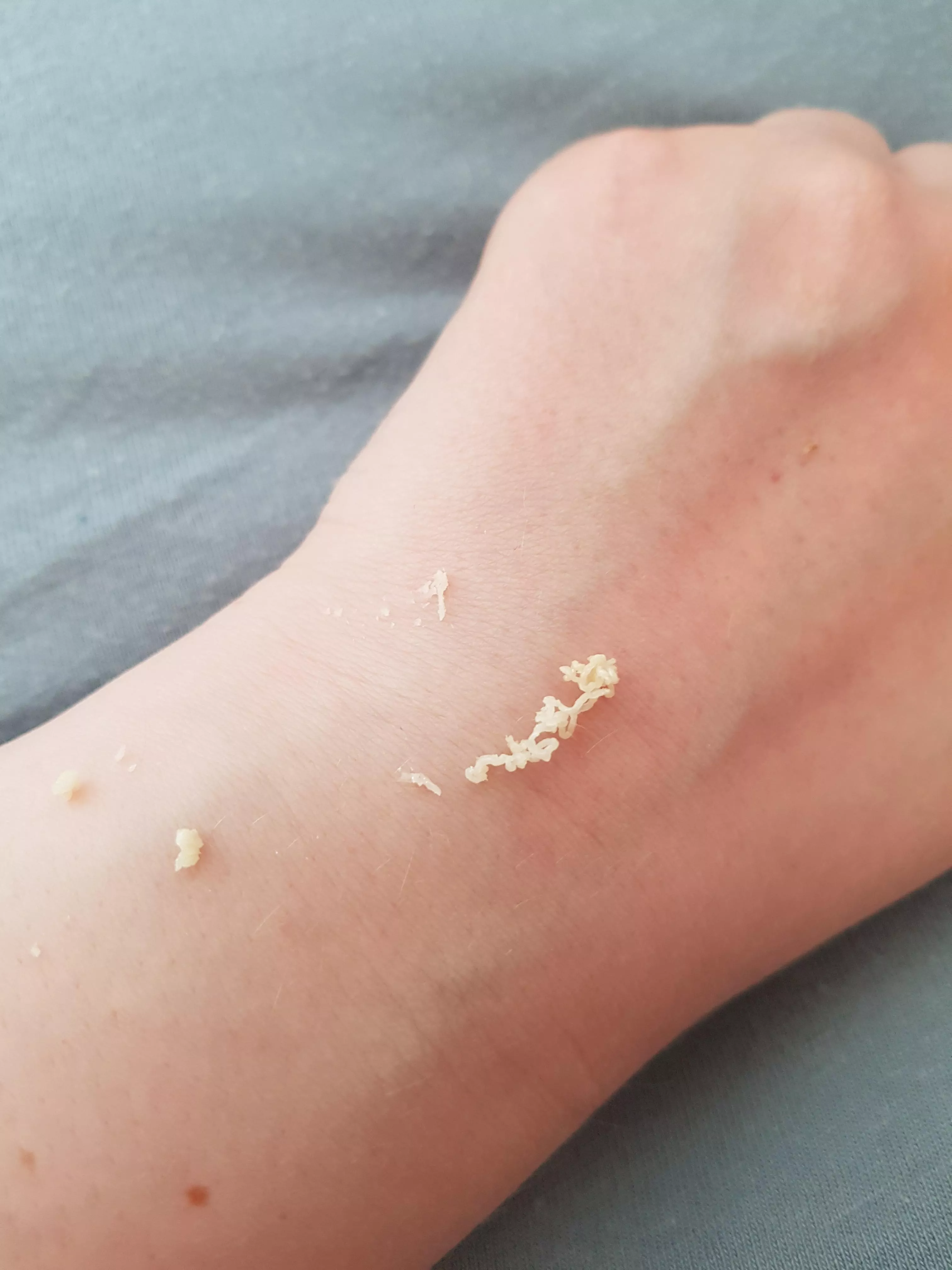 She let me squeeze this from her back on our first Tinder date