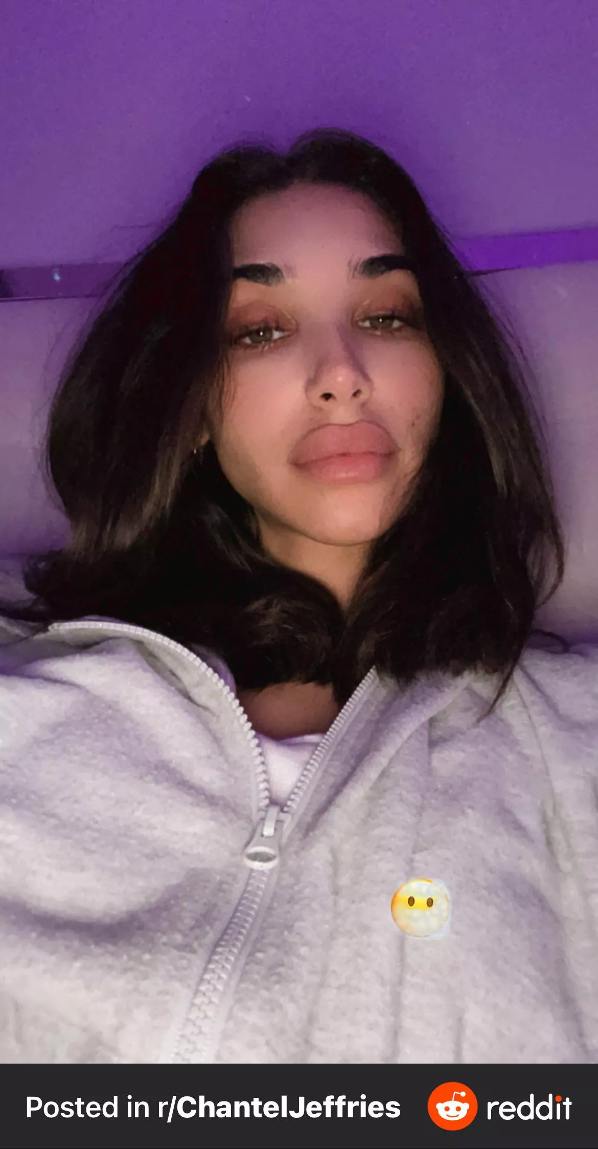 Chantel went even bigger with her lips and I’m fucking drooling