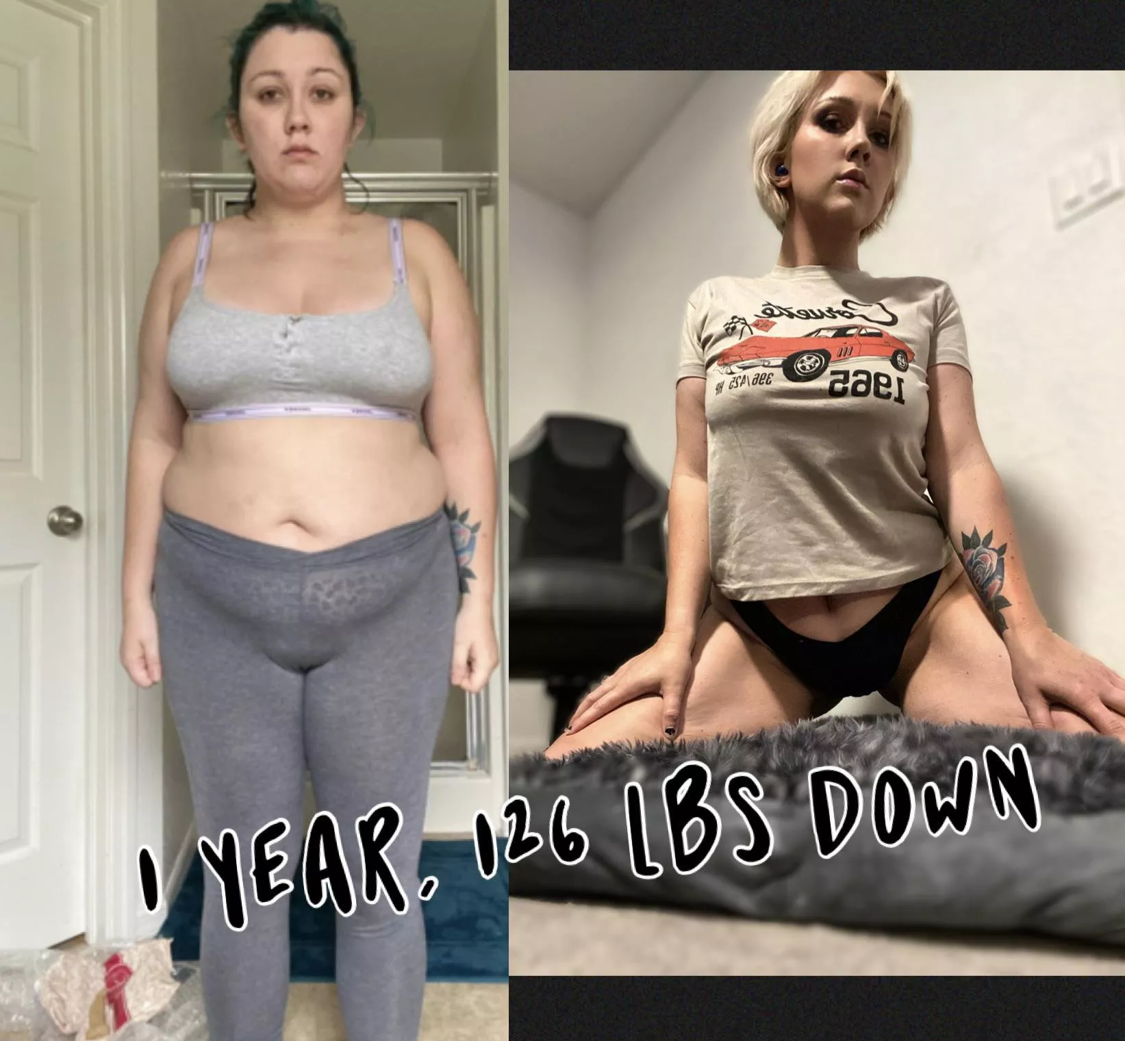 I can’t wait to get some 1200 ccs and a tummy tuck. 🥹