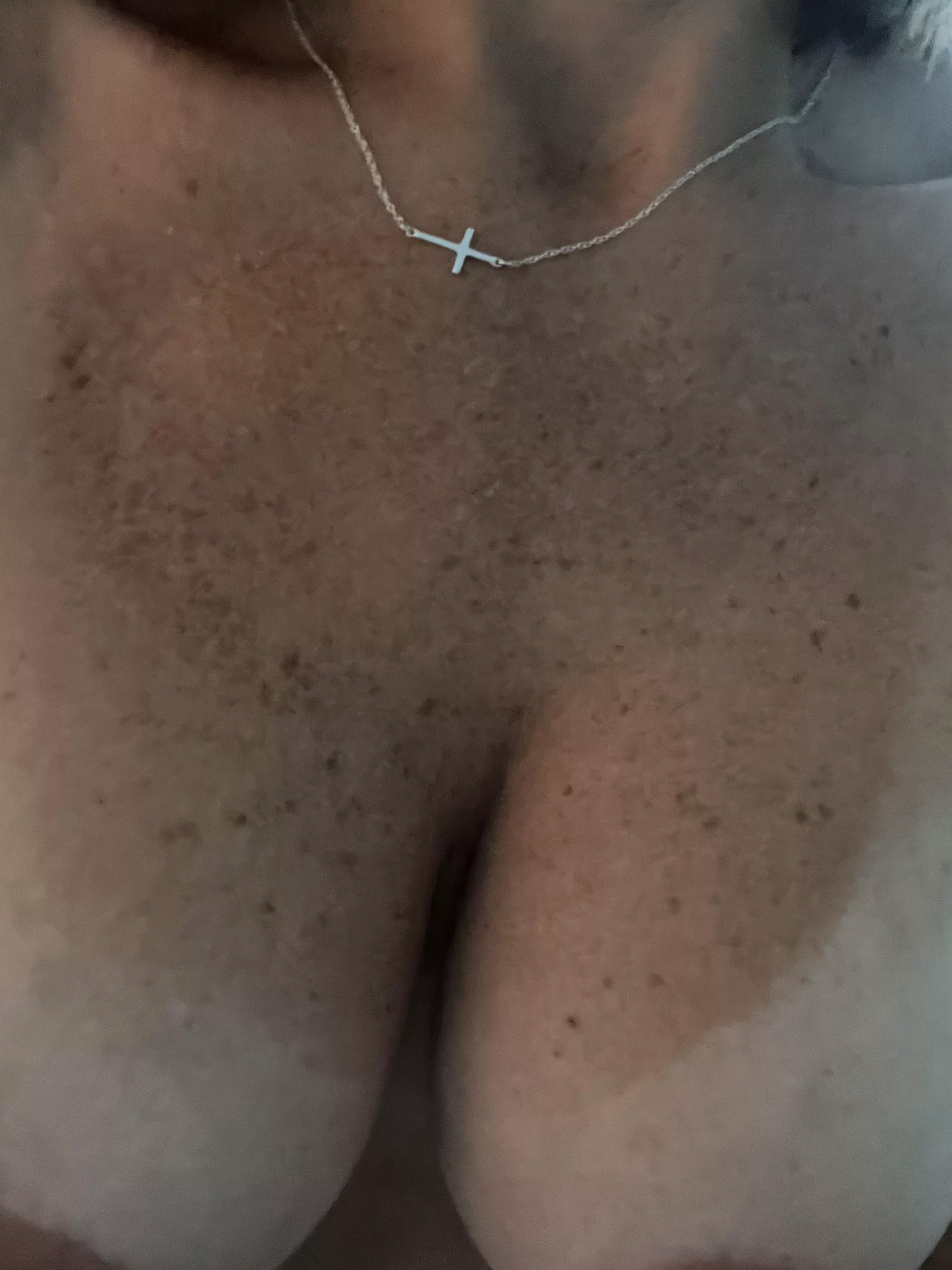 I’ve been told the freckles make good target practice. [OC]