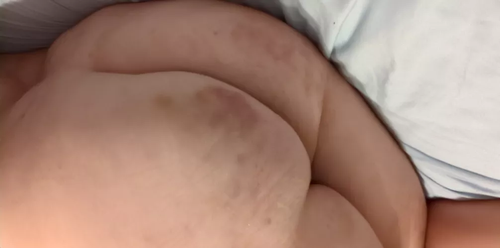 F[20] got a spanking on my bruised bottom 🥺 Sir clearly has favorite spots to spank