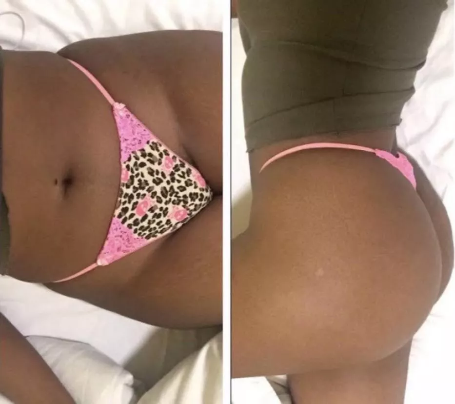 [32F] Front & side view 😋