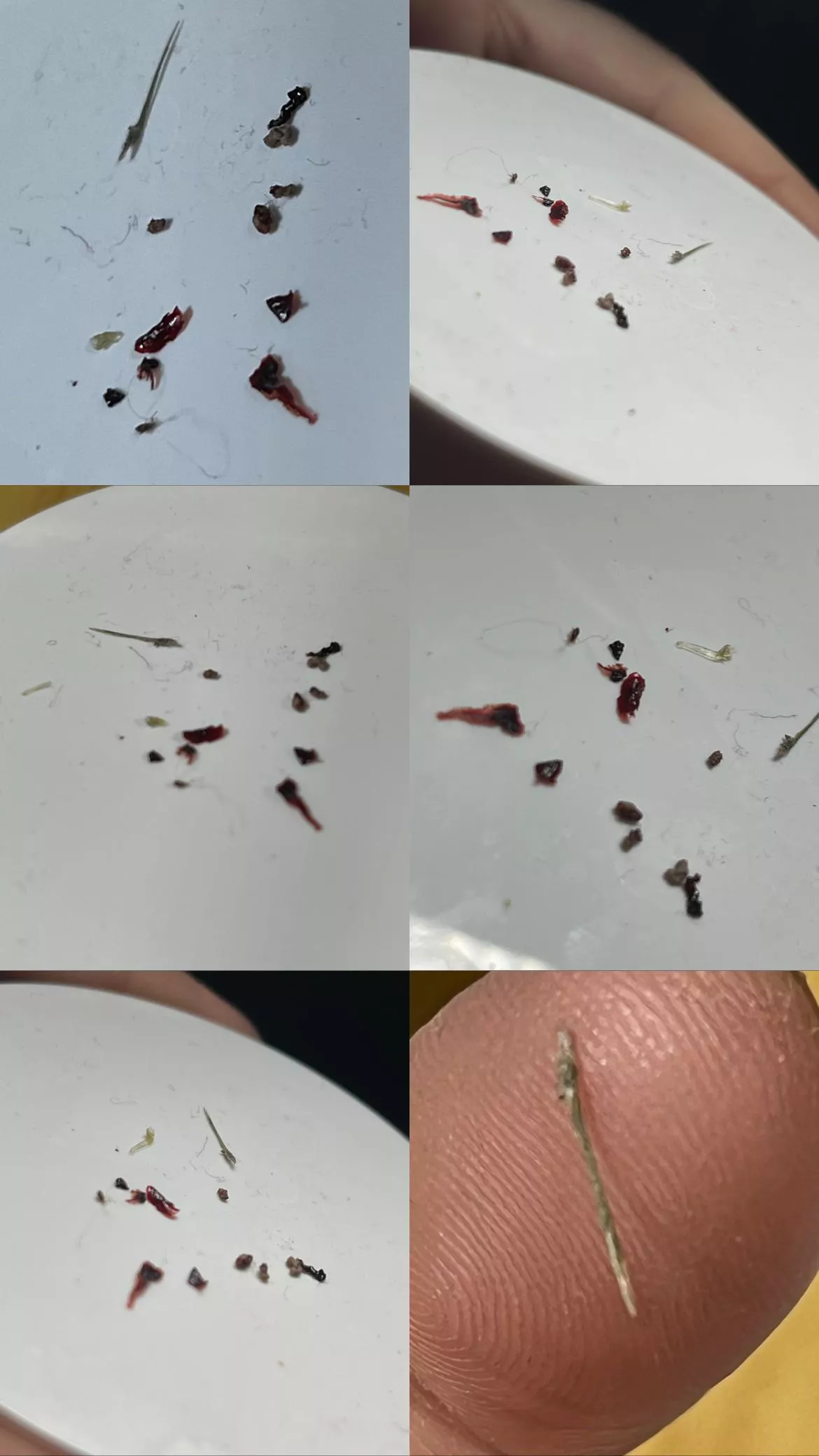 Ingrown Hairy and the Hendersons