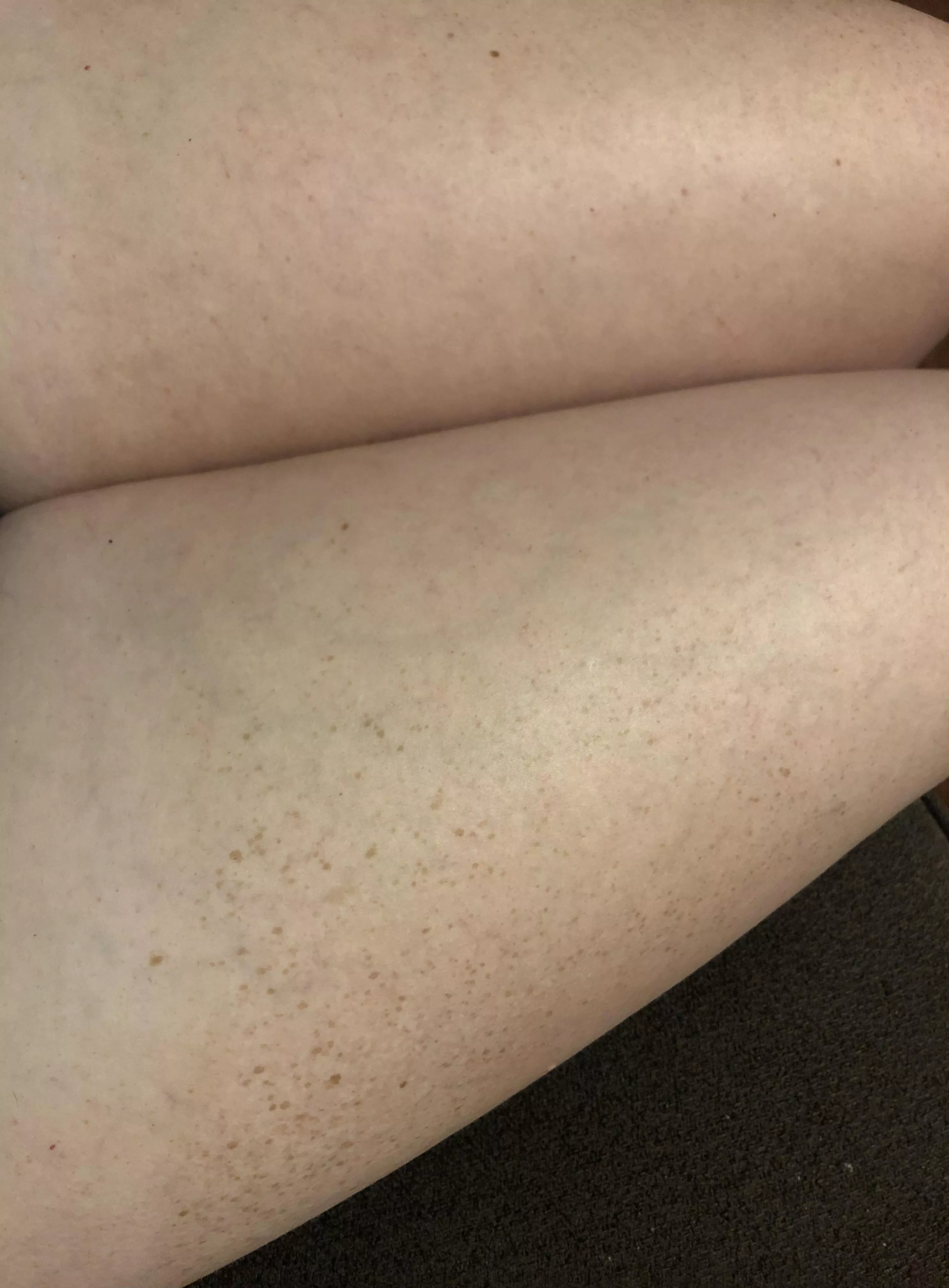 I want to go in the pool, maybe get some more freckles, maybe some tan lines