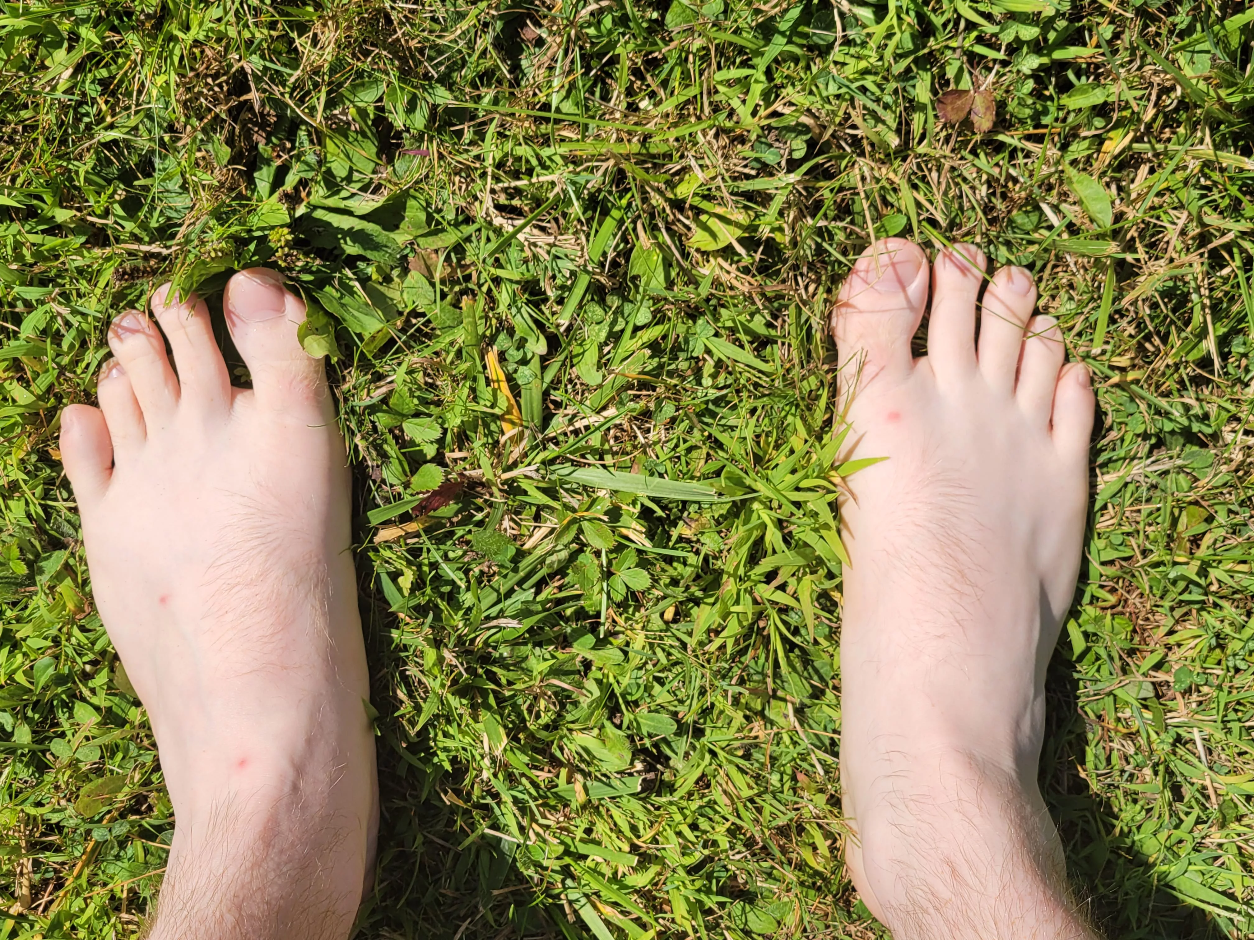 Mosquitos have attacked Master's size 15 feet. Which of you deserves the honor of rubbing lotion on them?