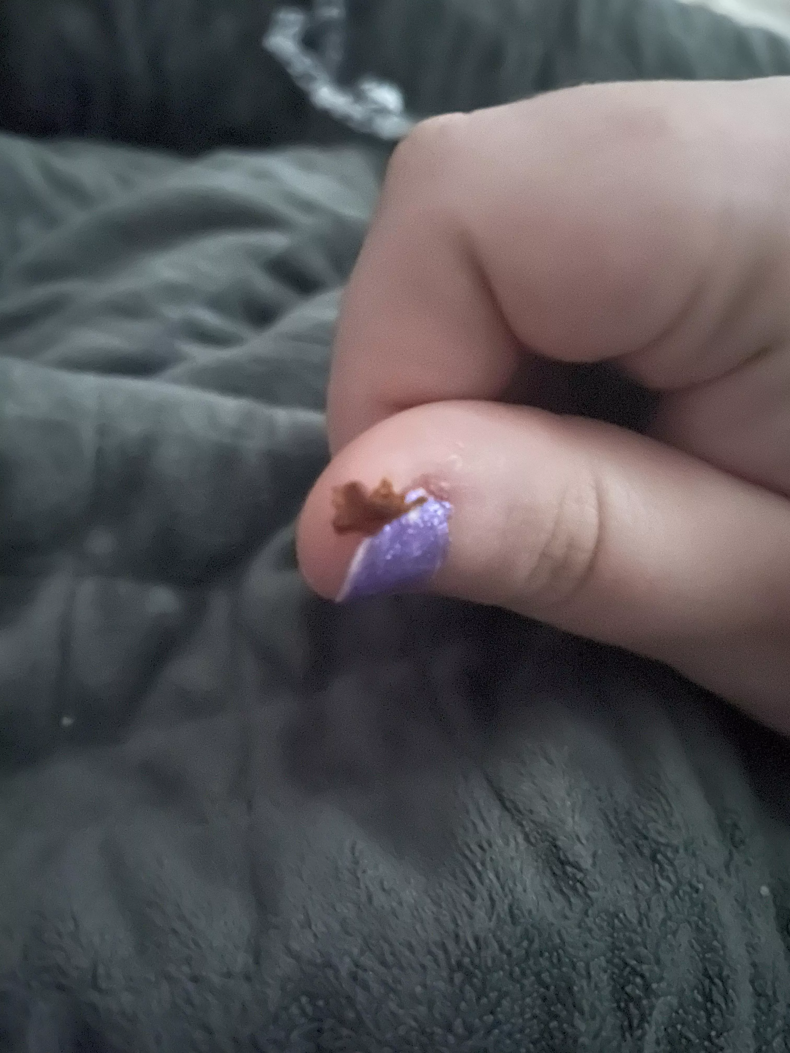 Just woke up with an itchy ear and this fell out? Skin I think