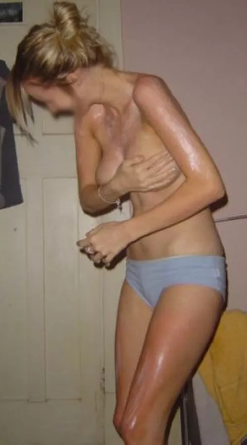 Wifey went to the beach and had too much time in the sun, secretly wants to show off her tanned body to you ☀️ 😋