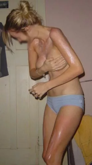 Wifey went to the beach and had too much time in the sun, secretly wants to show off her tanned body to you ☀️ 😋