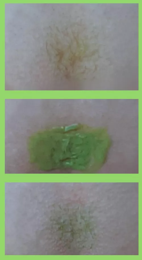 I’m new to sharing nsfw (so I’m sorry it doesn’t show much) but I tried green and I love it! I had laser hair removal years ago so there isn’t much left but I think I’m going to keep doing it (: