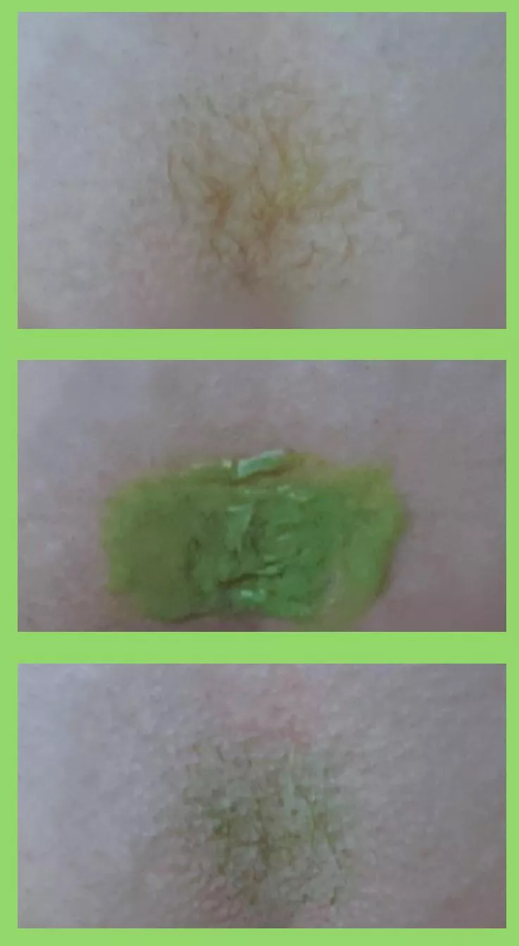 I’m new to sharing nsfw (so I’m sorry it doesn’t show much) but I tried green and I love it! I had laser hair removal years ago so there isn’t much left but I think I’m going to keep doing it (:
